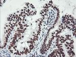 GSTT2 Antibody in Immunohistochemistry (Paraffin) (IHC (P))