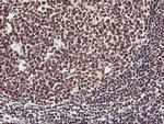 GSTT2 Antibody in Immunohistochemistry (Paraffin) (IHC (P))