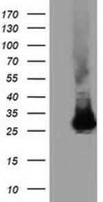 GSTT2 Antibody in Western Blot (WB)