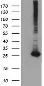 GSTT2 Antibody in Western Blot (WB)