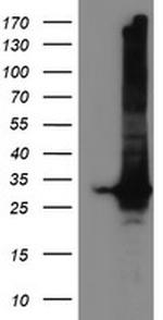 GSTT2 Antibody in Western Blot (WB)