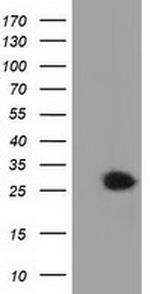 GSTT2 Antibody in Western Blot (WB)
