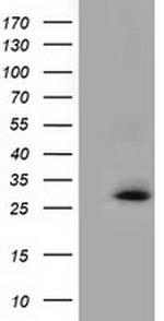 GSTT2 Antibody in Western Blot (WB)