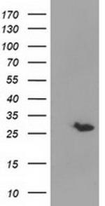 GSTT2 Antibody in Western Blot (WB)