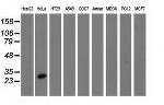 GSTT2 Antibody in Western Blot (WB)