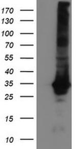 GSTT2 Antibody in Western Blot (WB)
