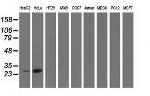 GSTT2 Antibody in Western Blot (WB)