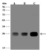 GSTZ1 Polyclonal Antibody