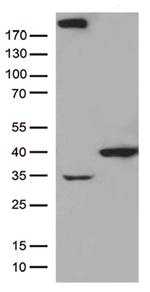 GTF2H3 Antibody in Western Blot (WB)
