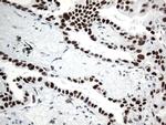 GTF3C4 Antibody in Immunohistochemistry (Paraffin) (IHC (P))