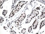 GTF3C4 Antibody in Immunohistochemistry (Paraffin) (IHC (P))