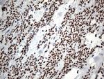 GTF3C4 Antibody in Immunohistochemistry (Paraffin) (IHC (P))