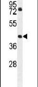 GTPBP8 Antibody in Western Blot (WB)