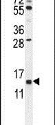 GTSF1 Antibody in Western Blot (WB)