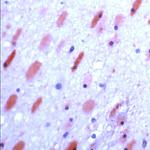 GluR6/GluR7 Antibody in Immunohistochemistry (IHC)