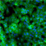 GLUT1 Polyclonal Antibody