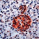 GAD65 Antibody in Immunohistochemistry (IHC)