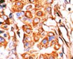 GK2 Antibody in Immunohistochemistry (IHC)