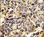 Glypican 1 Antibody in Immunohistochemistry (IHC)