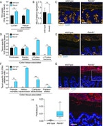 Gram Positive Bacteria LTA Antibody in Immunohistochemistry (IHC)
