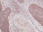 GM-CSF Antibody in Immunohistochemistry (Paraffin) (IHC (P))