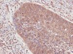 GM-CSF Antibody in Immunohistochemistry (Paraffin) (IHC (P))