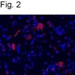 mGluR1 Polyclonal Antibody