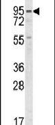 GUCY1A2 Antibody in Western Blot (WB)
