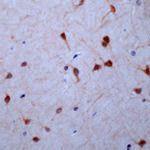 GUCY1B3 (soluble) Antibody in Immunohistochemistry (IHC)