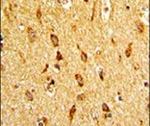 H-cadherin Antibody in Immunohistochemistry (IHC)