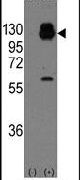 H-cadherin Antibody in Western Blot (WB)