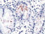 Helicobacter pylori Antibody in Immunohistochemistry (IHC)