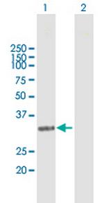 NAT1 Polyclonal Antibody, MaxPab™