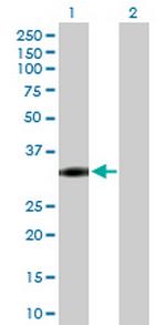 NAT1 Polyclonal Antibody, MaxPab™