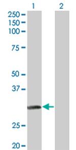 NAT2 Monoclonal Antibody (3B5)