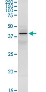 SERPINA3 Antibody in Western Blot (WB)