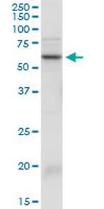 SERPINA3 Antibody in Western Blot (WB)