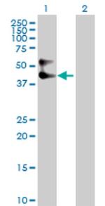 SERPINA3 Antibody in Western Blot (WB)