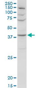 SERPINA3 Antibody in Western Blot (WB)