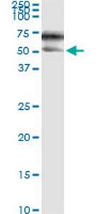 SERPINA3 Antibody in Immunoprecipitation (IP)