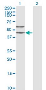 SERPINA3 Antibody in Western Blot (WB)