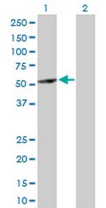 ABAT Antibody in Western Blot (WB)