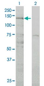 ABL2 Monoclonal Antibody (3D2)
