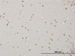 ABL2 Antibody in Immunohistochemistry (Paraffin) (IHC (P))