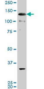ABL2 Antibody in Western Blot (WB)