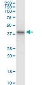 ABO Monoclonal Antibody (1B7)