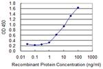 ACAA1 Antibody in ELISA (ELISA)