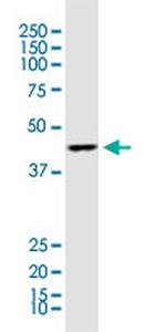 ACAA1 Antibody in Western Blot (WB)