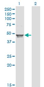 ACAA1 Antibody in Western Blot (WB)