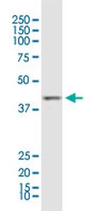 ACAA1 Antibody in Western Blot (WB)